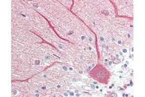 Human Brain, Cerebellum: Formalin-Fixed, Paraffin-Embedded (FFPE) (HDC 抗体  (AA 147-178))