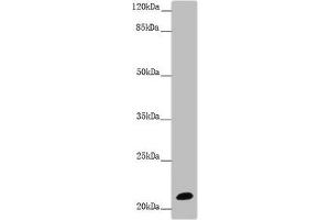 Western blot All lanes: NCALD antibody at 9. (NCALD 抗体  (AA 1-193))