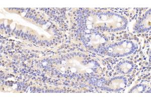 Detection of LDHB in Human Small intestine Tissue using Polyclonal Antibody to Lactate Dehydrogenase B (LDHB) (LDHB 抗体  (AA 1-334))