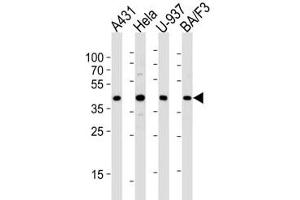 Western blot analysis of lysate from A431, HeLa, U-937, BA/F3 cell line (left to right) using PGK1 diluted at 1:1000 for each lane. (PGK1 抗体  (AA 305-334))