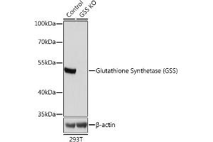 Western blot analysis of extracts from normal (control) and Glutathione Synthetase (Glutathione Synthetase (GSS)) knockout (KO) 293T cells, using Glutathione Synthetase (Glutathione Synthetase (GSS)) antibody (ABIN7267451) at 1:1000 dilution. (Glutathione Synthetase 抗体  (AA 373-474))