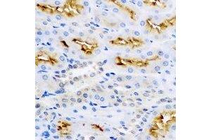 Immunohistochemical analysis of LC3B staining in rat kidney formalin fixed paraffin embedded tissue section.