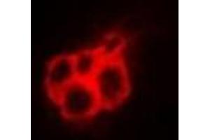 Immunofluorescent analysis of Annexin A4 staining in A549 cells. (Annexin IV 抗体)