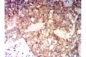 Immunohistochemistry (IHC) image for anti-CD99 (CD99) (AA 1-185) antibody (ABIN7193656)