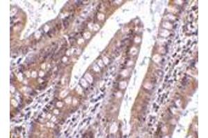 Immunohistochemistry of CIDE-B in human small intestine tissue with CIDE-B antibody at 5 μg/ml. (CIDEB 抗体  (C-Term))