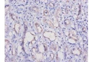 Immunohistochemistry of paraffin-embedded human kidney tissue using ABIN7177289 at dilution of 1:50 (HAVCR1 抗体  (AA 22-237))