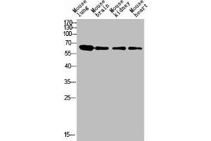 Western blot analysis of human blood lysate, antibody was diluted at 1000. (LGALS3BP 抗体  (AA 100-160))