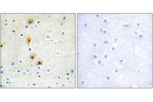 Immunohistochemistry analysis of paraffin-embedded human brain tissue, using Akt (Ab-326) Antibody. (AKT1 抗体  (AA 292-341))