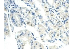 Immunohistochemistry (IHC) image for anti-Nicotinamide phosphoribosyltransferase (NAMPT) (AA 1-491) antibody (ABIN7432295)