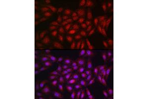 Immunofluorescence analysis of U2OS cells using PPARγ Rabbit pAb (ABIN3020843, ABIN3020844, ABIN3020845, ABIN1513399 and ABIN6213752) at dilution of 1:200 (40x lens). (PPARG 抗体  (AA 50-150))