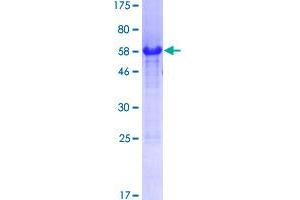 Image no. 1 for Polymerase (RNA) III (DNA Directed) Polypeptide H (22.9kD) (POLR3H) (AA 1-204) protein (GST tag) (ABIN1315718) (POLR3H Protein (AA 1-204) (GST tag))