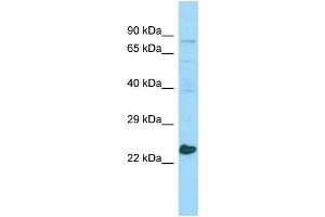 WB Suggested Anti-MED20 Antibody Titration: 1. (MED20 抗体  (Middle Region))