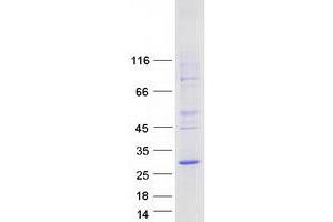 Validation with Western Blot