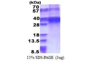 SDS-PAGE (SDS) image for Four and A Half LIM Domains 3 (FHL3) (AA 1-280) protein (His tag) (ABIN5853348) (FHL3 Protein (AA 1-280) (His tag))