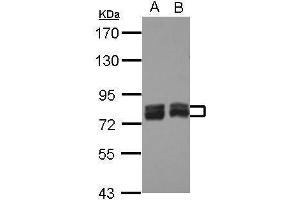 Western Blotting (WB) image for anti-Acyl-CoA Synthetase Long-Chain Family Member 4 (ACSL4) (C-Term) antibody (ABIN2854678)