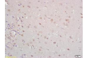 Formalin-fixed and paraffin embedded rat brain labeled with Anti Tomoregulin-1 Polyclonal Antibody, Unconjugated (ABIN762686) at 1:200 followed by conjugation to the secondary antibody and DAB staining
