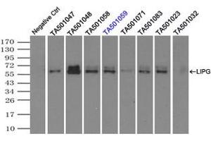 Image no. 2 for anti-Lipase, Endothelial (LIPG) antibody (ABIN1499176) (LIPG 抗体)