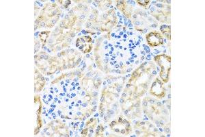 Immunohistochemistry (Paraffin-embedded Sections) (IHC (p)) image for anti-Toll-Interleukin 1 Receptor (TIR) Domain Containing Adaptor Protein (TIRAP) (AA 1-221) antibody (ABIN6149192)