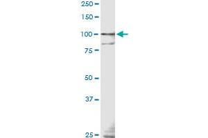 TLR9 monoclonal antibody (M04), clone 3B7 Western Blot analysis of TLR9 expression in IMR-32 . (TLR9 抗体  (AA 99-215))