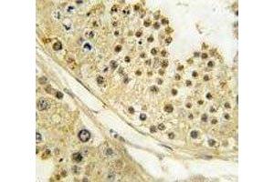 Immunohistochemistry (IHC) image for anti-Aurora Kinase B (AURKB) (AA 6-35) antibody (ABIN3030076)