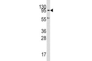 Western blot analysis of Dnmt3a antibody and HepG2 lysate. (DNMT3A 抗体  (AA 723-752))