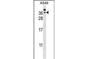 Western Blotting (WB) image for anti-General Transcription Factor IIE, Polypeptide 2 (GTF2E2) (AA 240-269), (C-Term) antibody (ABIN5533296)