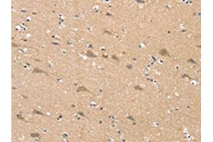 The image on the left is immunohistochemistry of paraffin-embedded Human brain tissue using ABIN7192347(SGPL1 Antibody) at dilution 1/25, on the right is treated with synthetic peptide. (SGPL1 抗体)