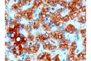 IHC testing of FFPE human liver with DGAT2 antibody at 3ug/ml. (DGAT2 抗体)