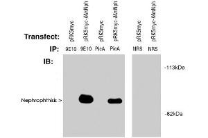 Western blot of Nephrophthisis (pic) polyclonal antibody  used at 2! (NPHP1 抗体  (AA 612-691))