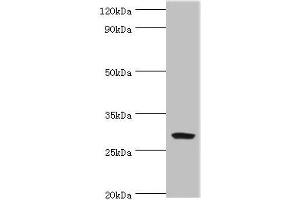 Western blot All lanes: Spindlin-2B antibody at 4 μg/mL + Mouse gastric tissue Secondary Goat polyclonal to rabbit IgG at 1/10000 dilution Predicted band size: 29 kDa Observed band size: 29 kDa (Spindlin 2B 抗体  (AA 1-258))
