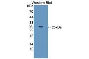 Western blot analysis of the recombinant protein. (ITIH5 抗体  (AA 569-737))