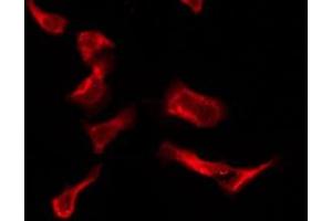 ABIN6276198 staining HeLa by IF/ICC. (P2RY4 抗体  (C-Term))