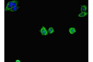 Immunofluorescent analysis of HepG2 cells using ABIN7154947 at dilution of 1:100 and Alexa Fluor 488-congugated AffiniPure Goat Anti-Rabbit IgG(H+L)