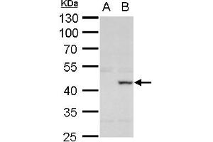 Western Blotting (WB) image for anti-X-Ray Repair Complementing Defective Repair in Chinese Hamster Cells 3 (XRCC3) (C-Term) antibody (ABIN2857069)