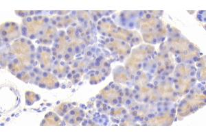 Immunohistochemistry (IHC) image for anti-Carboxypeptidase A1 (Pancreatic) (CPA1) (AA 205-419) antibody (ABIN7435979)
