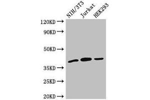 Western Blot Positive WB detected in: NIH/3T3 whole cell lysate, Jurkat whole cell lysate, HEK293 whole cell lysate All lanes: SPRY2 antibody at 2. (SPRY2 抗体  (AA 2-97))