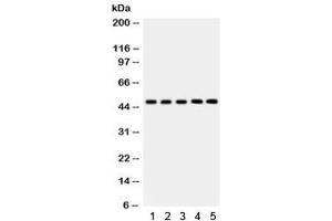 Western blot testing of 1) rat liver, 2) mouse liver, 3) human SMMC, 4) RH35 and 5) HepG2 lysate with YB1 antibody. (YBX1 抗体)