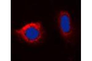 Immunofluorescent analysis of Calnexin (pS583) staining in HeLa cells.