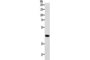 Western Blotting (WB) image for anti-SRY (Sex Determining Region Y)-Box 7 (SOX7) antibody (ABIN2428741) (SOX7 抗体)
