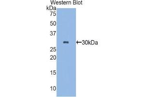 Western blot analysis of the recombinant protein. (Plastin 3 抗体  (AA 234-475))