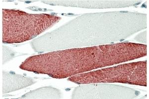 AP32711PU-N TNNI3 Antibody staining of paraffin embedded Human Skeletal Muscle at 5 µg/ml. (TNNT3 抗体)