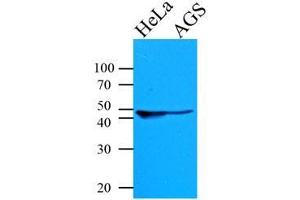 Cell lysates of HeLa and AGS (35 ug) were resolved by SDS-PAGE, transferred to PVDF membrane and probed with anti-human KRT18 (1:1000). (Cytokeratin 18 抗体  (AA 79-430))