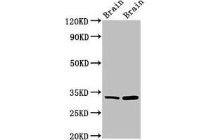 Western Blot Positive WB detected in: Mouse brain tissue, Rat brain tissue All lanes: HAX1 antibody at 1. (HAX1 抗体  (AA 2-250))