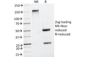 SDS-PAGE Analysis of Purified, BSA-Free Insulin Antibody (clone IRDN/794). (Insulin 抗体)