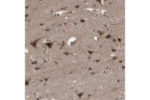 Immunohistochemical staining of human cerebral cortex with KANSL1 polyclonal antibody  shows strong cytoplasmic and nuclear positivity in neuronal cells. (KANSL1 抗体)