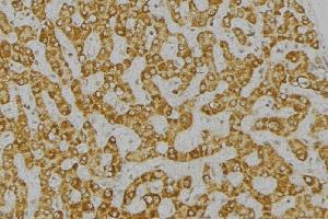 ABIN6276770 at 1/100 staining Mouse liver tissue by IHC-P. (DPYD 抗体  (Internal Region))