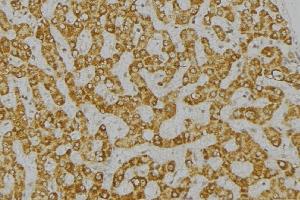 ABIN6276770 at 1/100 staining Mouse liver tissue by IHC-P.