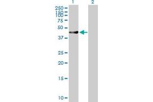 Western Blot analysis of RUSC1 expression in transfected 293T cell line by RUSC1 MaxPab polyclonal antibody. (RUSC1 抗体  (AA 1-433))