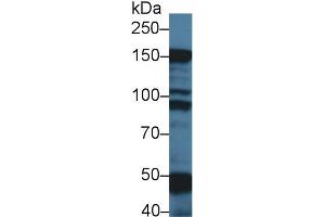 Western Blot; Sample: Rat Skeletal muscle lysate; Primary Ab: 1µg/ml Rabbit Anti-Mouse MYBPC1 Antibody Second Ab: 0. (MYBPC1 抗体  (AA 1-277))