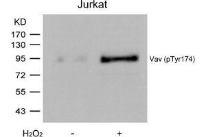 Western blot analysis of extracts from Jurkat cells untreated or treated with H2O2 using Vav(Phospho-Tyr174) Antibody. (VAV1 抗体  (pTyr174))